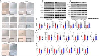 Polycystin-1 Downregulation Induced Vascular Smooth Muscle Cells Phenotypic Alteration and Extracellular Matrix Remodeling in Thoracic Aortic Dissection